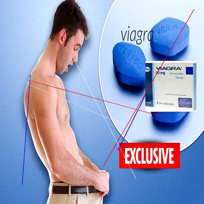 Ou acheter viagra en france forum